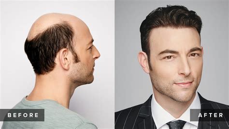 10,000 Surprising Facts About Mens Hair Extensions