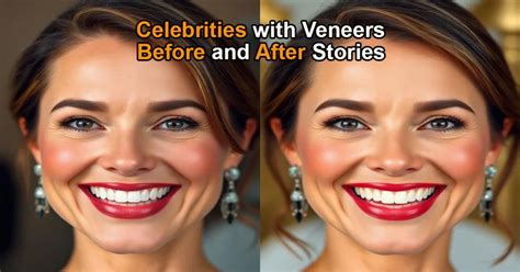 10 Celebrities with Disastrous Veneers: A Hollywood Horror Story