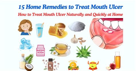 10 Effective Strategies to Cure Tongue Ulcers