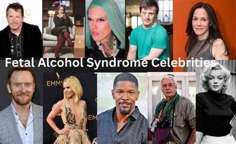 10 Famous Celebrities with Fetal Alcohol Syndrome