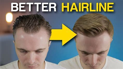 10 Questions About Male Lace Fronts You Were Too Embarrassed to Ask