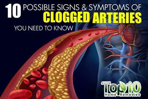 10 Unmistakable Signs of Blocked Arteries in Heart