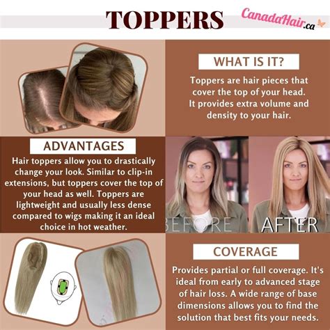 1000+ Hair Loss Toppers: The Ultimate Guide