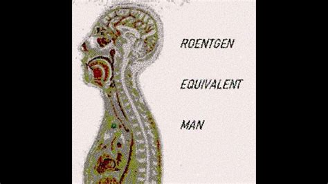 10000 REM: The Roentgen Equivalent Man