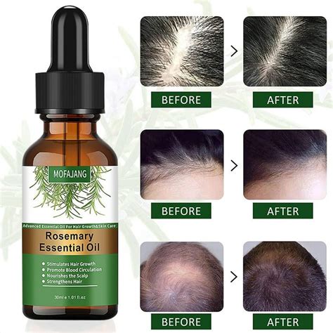 101 Hair Growth Enhancing Oil: Unveil the Secret to Luscious Locks