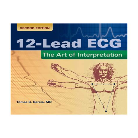 12 lead ecg the art of interpretation Ebook PDF