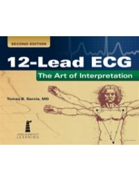 12 lead ecg the art of interpretation Ebook PDF