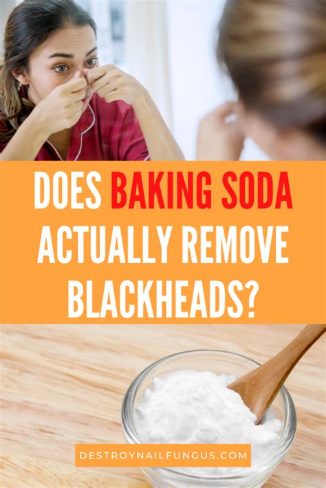 15 Instant Blackhead Removal Hacks with Baking Soda