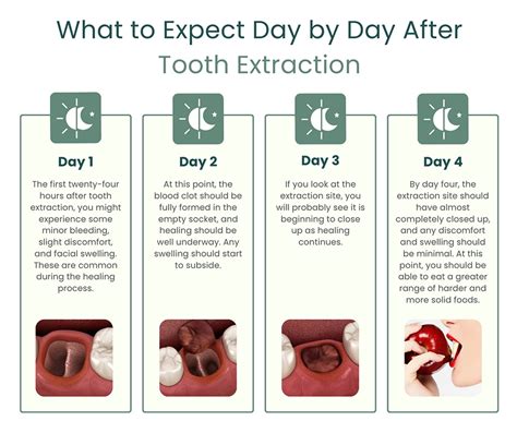 2 Weeks After Wisdom Teeth Removal: A Comprehensive Guide to Recovery