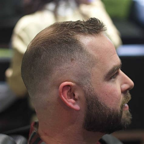 20 Stylish Haircuts for a Balding Crown