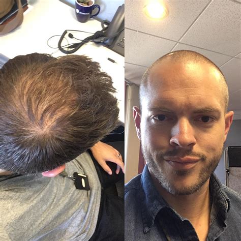 23 Balding Crown Hairstyles for Men: Enhance Your Look