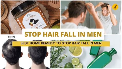 3 Definitive Ways to Stop Hair Fall for Men in 2025: Battle Hair Loss with Confidence