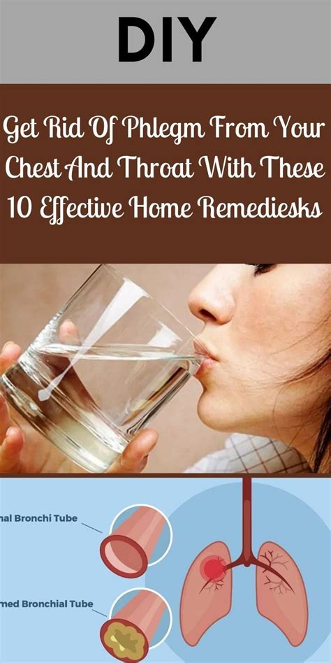 3 Easy Ways to Get Rid of Phlegm in Throat Today