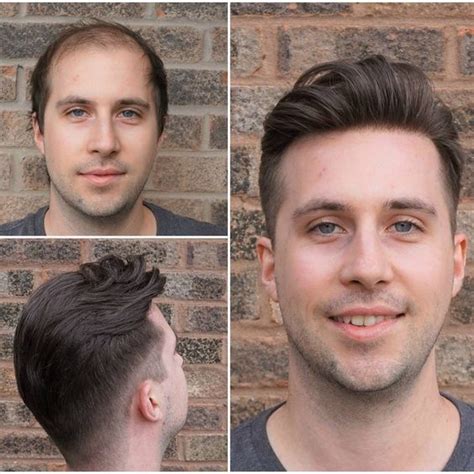 3 Professional Hair Pieces For Men That Look Real