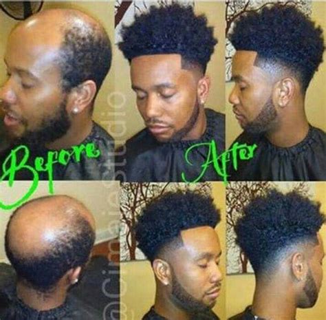 3 Shocking Truths About Men's Lace Fronts the Hair Industry Doesn't Want You to Know