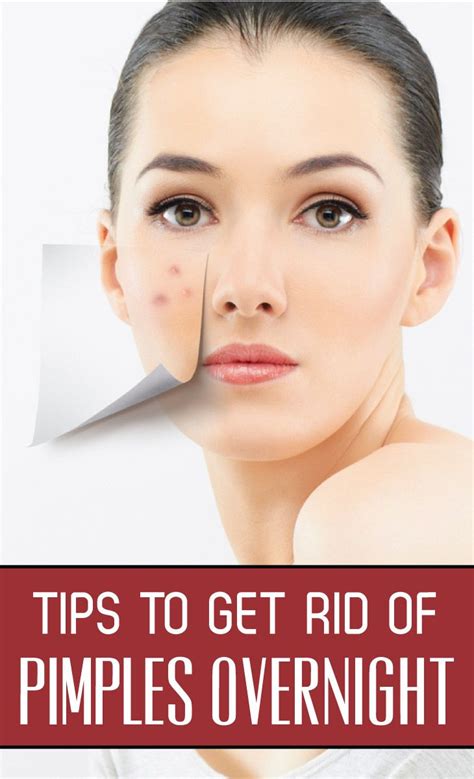 30 Essential Tips to Eliminate Pimples Around the Mouth