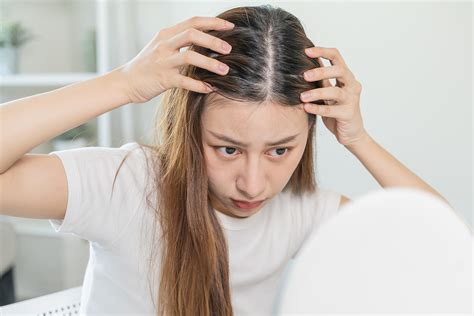 32% of Women Struggle with Hair Loss