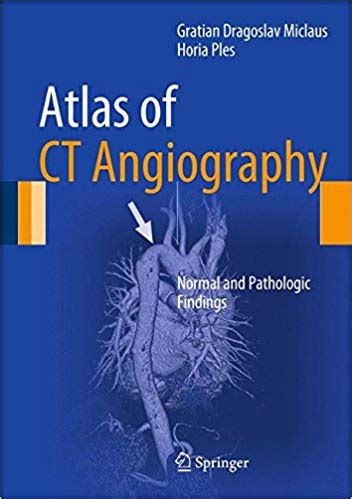 3319052837Angiography Ebook Epub