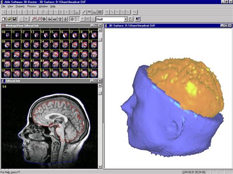 3D Imaging and Modeling: