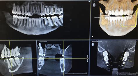 3D X-ray imaging: