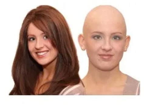 5,000+ Chemo Wigs: Find Yours Today!