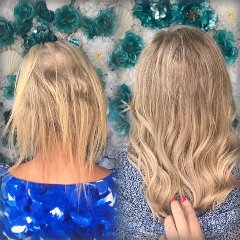 5 Best Hair Extensions for a Flawless Transformation