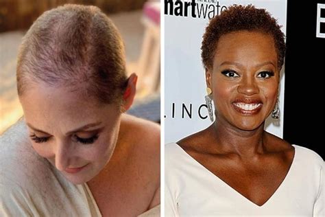 5 Black Actresses Who Own Their Baldness