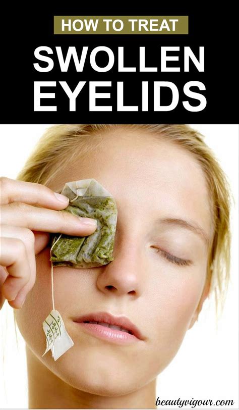 5 Fast and Effective Swollen Eyelid Treatments