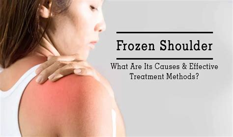 5 Frozen Shoulder Cures in 1 Minute or Less in 2025