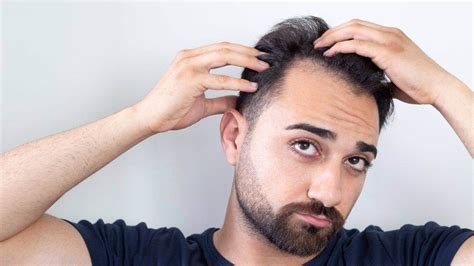 5 Hair Replacement Hair Benefits (+12 Common Mistakes to Avoid)