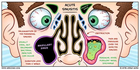 5 Infections Inside Your Nose You Need to Know