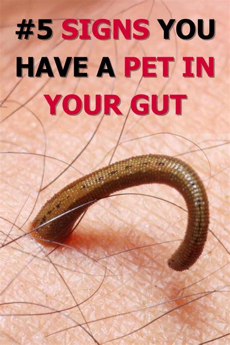 5 Surefire Signs You Might Have Intestinal Worms in 2025: A Comprehensive Guide