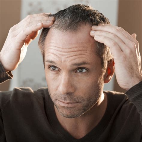 5 Things Every Man Should Know About Toupees