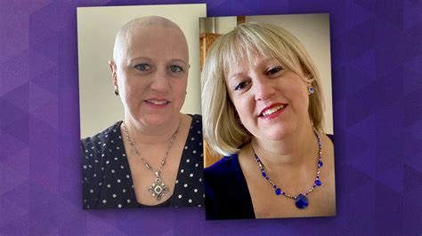 5 Unforgettable Wigs for Cancer Patients to Restore Confidence