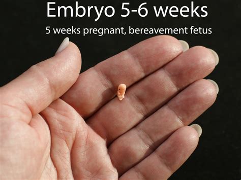 5-Week Fetus: A Journey Through Transformation