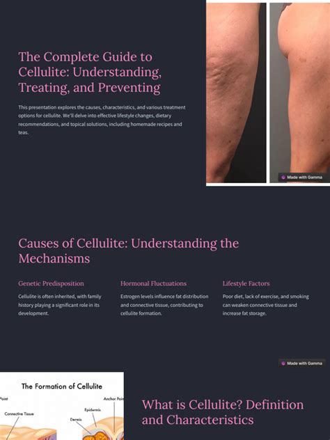 50 Shades of Anastasia: A Comprehensive Guide to Understanding, Preventing, and Treating Cellulite