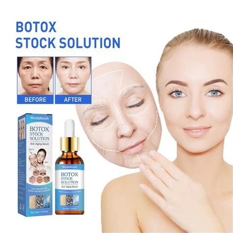 6 Best Botox Stock Solution Reviews: A Comprehensive Guide for 2023