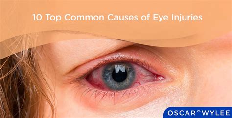 6 Common Causes of Eyes and Head Hurt from Computer Use and How to Prevent Them