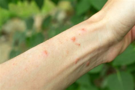 6 Red Bumps on Arms No Itching: Causes and Remedies