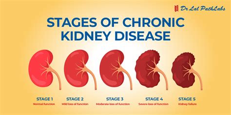 7 Critical Problems of Kidney Disease You Need to Know