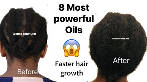 7 Powerful Oils for Phenomenal Hair Growth