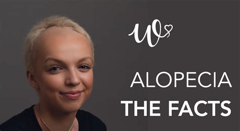 7 Surprising Facts About Alopecia Wigs