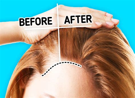 8 Reasons Why You're Losing Hair on Top of Your Head and How to Stop It