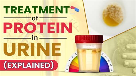 9 Warning Signs Your Urine Is Telling You About Protein Overload