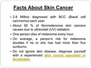 90% of non-melanoma skin cancers