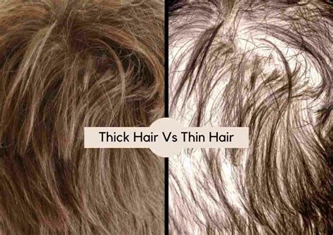 97 Interesting Facts About Fine vs Thick Scalp: What You Need To Know