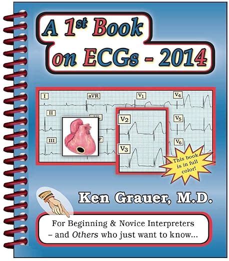 A 1st Book on ECGs-2014 Epub