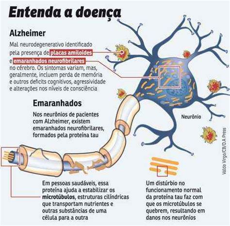 A Beta Amiloide e seu Papel Vital na Doença de Alzheimer