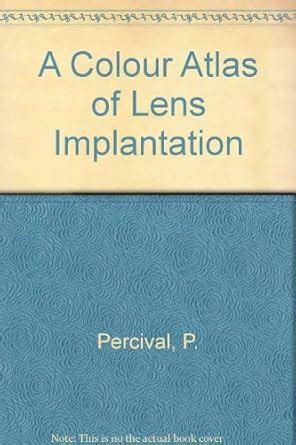 A Color Atlas of Lens Implantation Kindle Editon