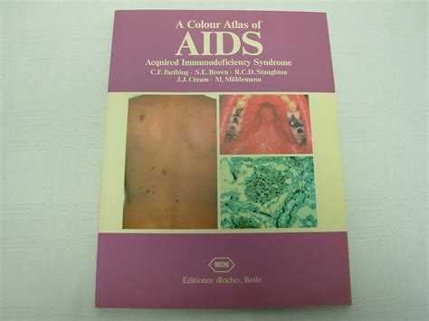 A Colour Atlas of AIDS Acquired Immunodeficiency Syndrome Reader